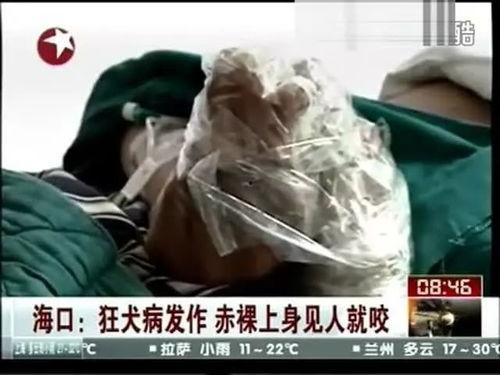 狂犬病 日本,日本防控与启示